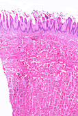 Filiform papillae, light micrograph