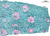 Human skin dermis, light micrograph