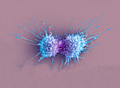 Cervical cancer cells dividing, SEM