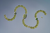 Anabaena sp. cyanobacteria, light micrograph