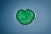 Woronichina naegeliana cyanobacteria, light micrograph