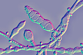 Microsporum audouinii fungus,
