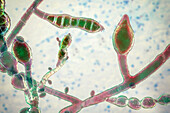 Microsporum audouinii fungus, illustration