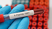C-Peptide diabetes blood test, conceptual image