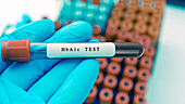 Haemoglobin A1c blood test, conceptual image