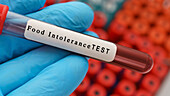 Food intolerance blood test, conceptual image
