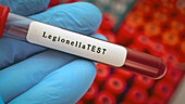 Legionella blood test, conceptual image