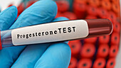 Progesterone hormone test, conceptual image