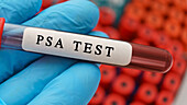 Prostate-specific antigen test, conceptual image