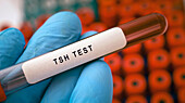 Thyroid stimulating hormone (TSH) test, conceptual image