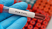 Stem cells sample, conceptual image