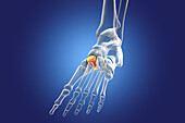 Intermediate cuneiform bone, illustration