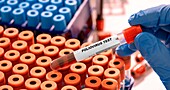 Poliovirus blood test, conceptual image