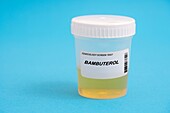 Urine test for bambuterol