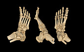 Right foot, 3D CT scans