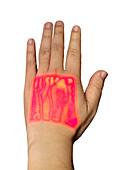 Hand veins shown by infrared finder