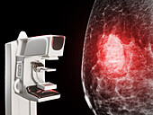 Mammography, conceptual image