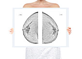 Breast cancer screening, conceptual image