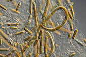 Lyngbya sp. algae, light micrograph