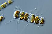 Chaetoceros sp. algae, light micrograph