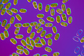Actinotaenium silvae-nigrae cf. algae, light micrograph
