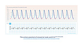 Action potential of sinoatrial node and ECG, illustration