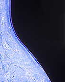 Peri-implant junctional epithelium, light micrograph