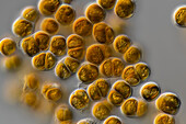 Ochrosphaera verrucosa cf. algae, light micrograph