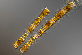 Orthoseira sp. algae, light micrograph