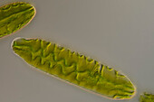 Netrium elongatum - nepalense cf. algae, light micrograph