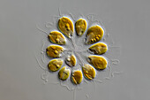 Synura sp. algae, light micrograph