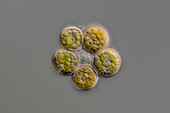 Coenochloris fottii cf. algae, light micrograph