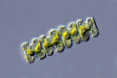 Teilingia granulata algae, light micrograph