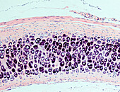 Hyaline cartilage, light micrograph