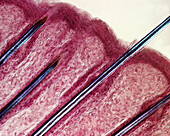 Hairs, light micrograph