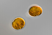 Peridinium centenniale algae, light micrograph