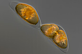 Pyrocystis sp. cf. algae, light micrograph