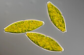 Tetmemorus granulatus algae, light micrograph