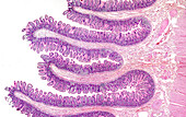 Small intestine, light micrograph