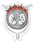 Twin foetuses, illustration