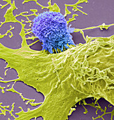 Natural killer cell, SEM