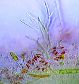 Microalgae settled on Lemna sp. root, light micrograph