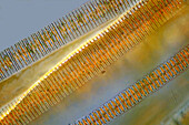 Fragilaria diatoms, light micrograph