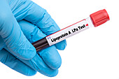 Lipoprotein A test, conceptual image