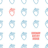 Coronary artery disease, conceptual illustration