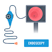 Endoscopy equipment, illustration