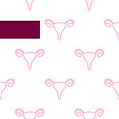 Endometriosis, conceptual illustration