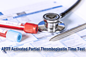 Activated partial thromboplastin time test, conceptual image