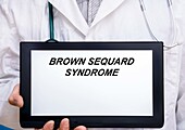 Brown-Sequard syndrome, conceptual image