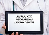 Histiocytic necrotizing lymphadenitis, conceptual image